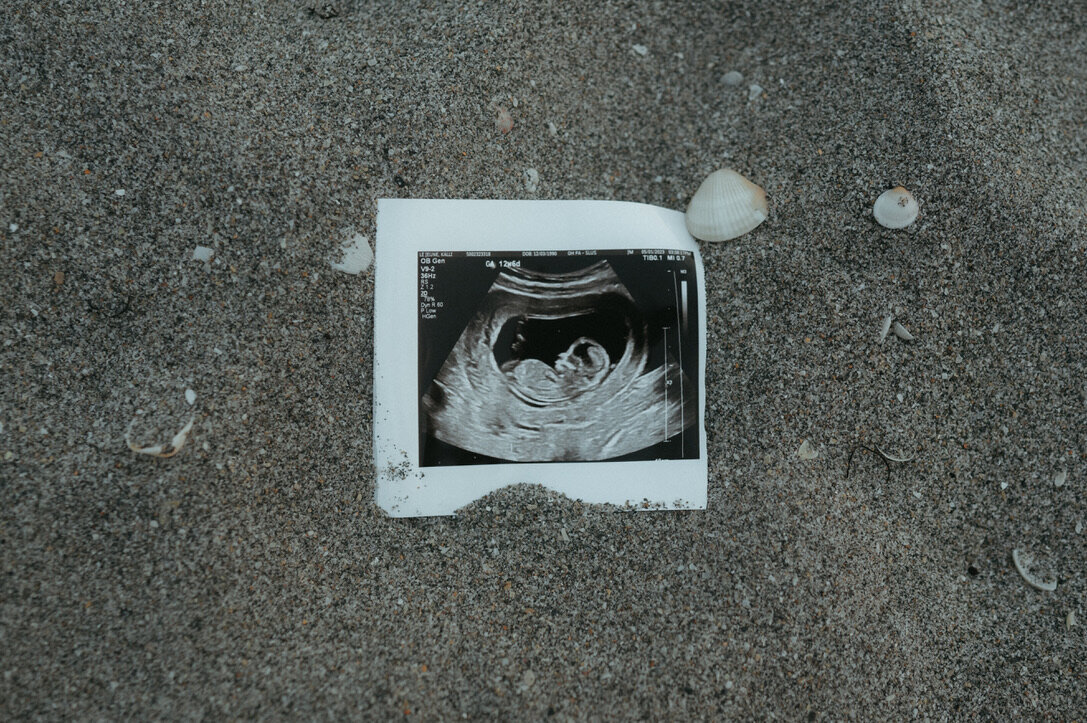 photo of sonogram during maternity session