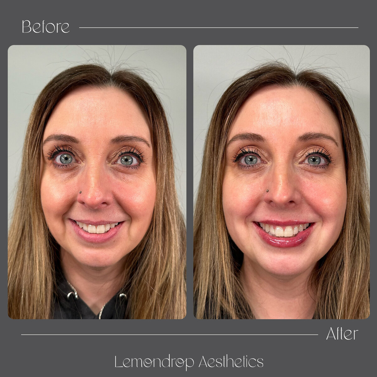 BEFORE:AFTER VERTICAL copy