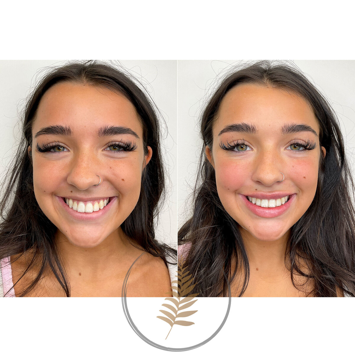 BEFORE-AFTER02 2