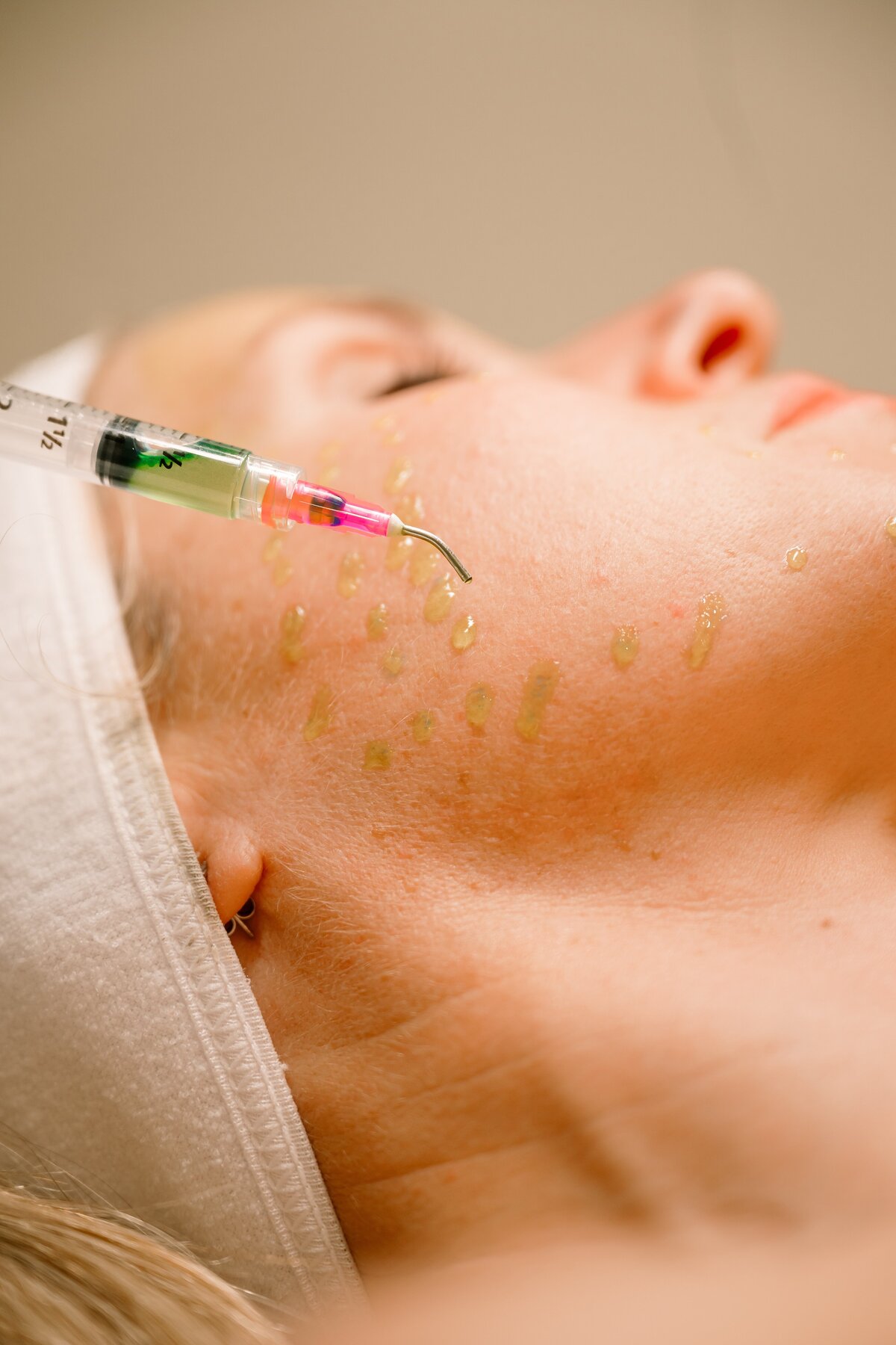 diamond glow being administered to a client at derma precision