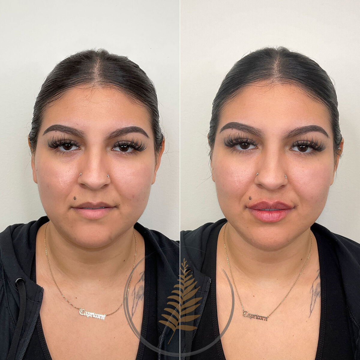 FACESINBLOOM_BEFOREAFTER_LIPS_07