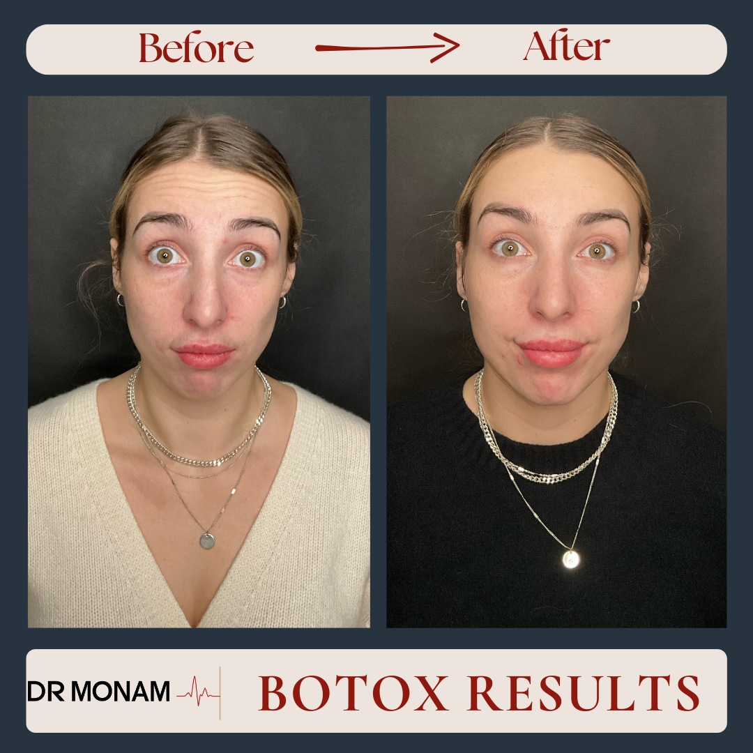 Neutral Before and After Instagram Post-17