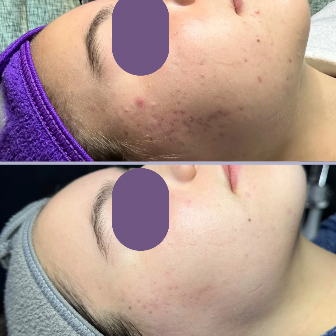 Isabel A B&A - 1