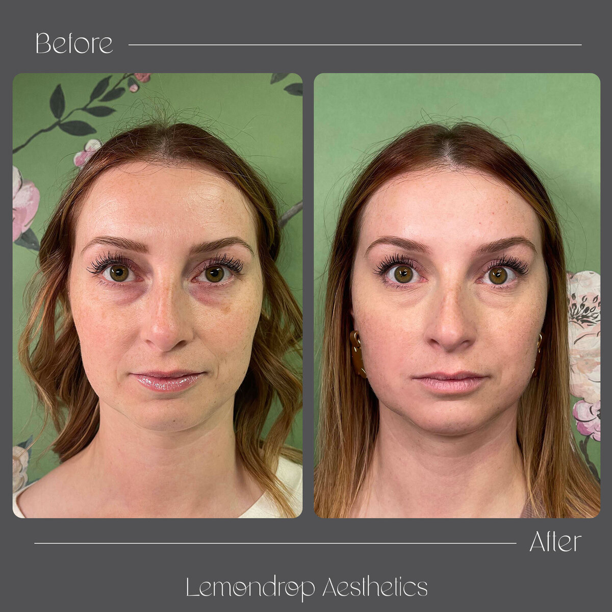 BEFORE-AFTER copy 10