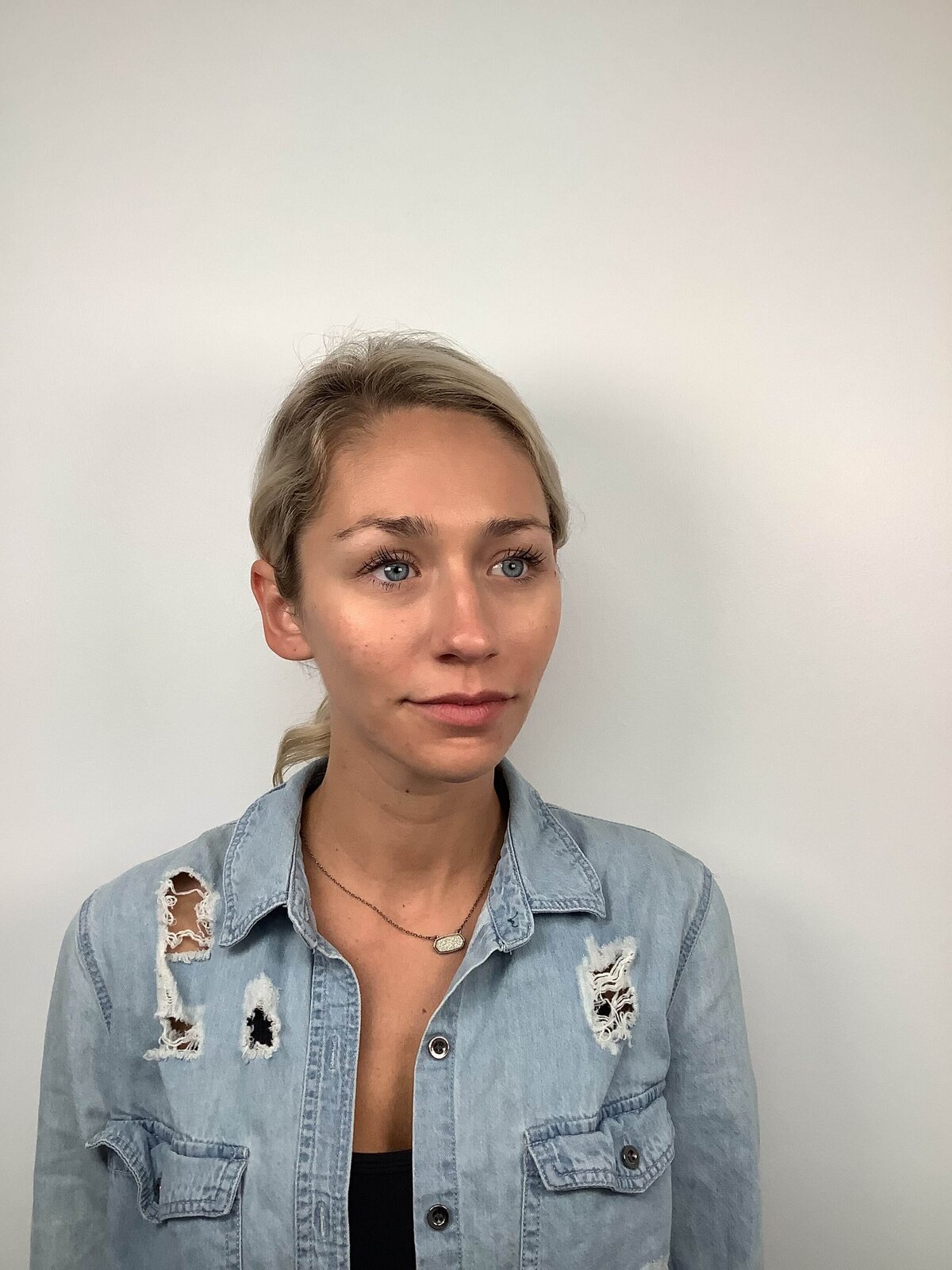 after facial balancing (5)