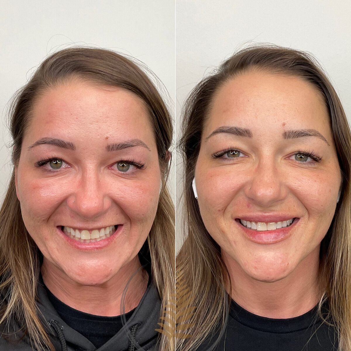BEFORE:AFTER02 copy 18