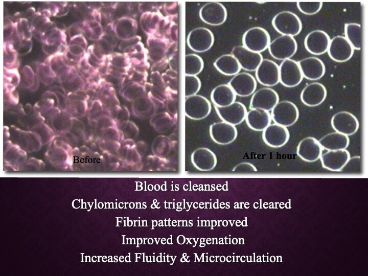 slide38