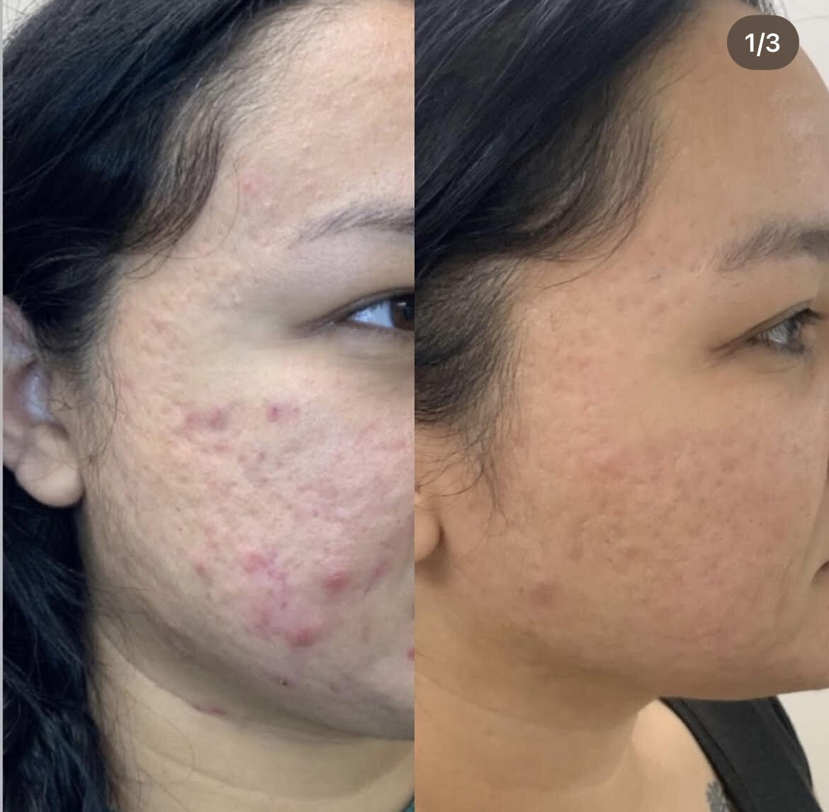 Medical Grade Skincare 