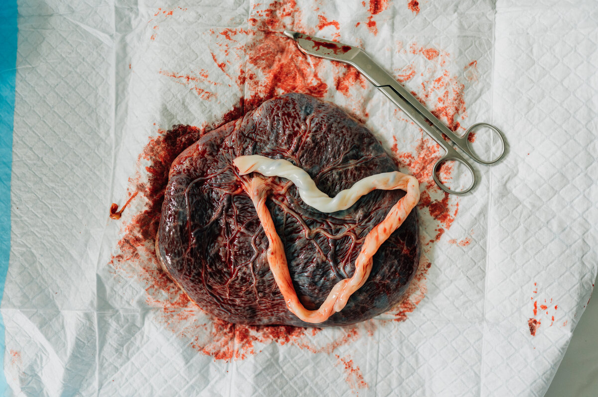birth-photographer-155