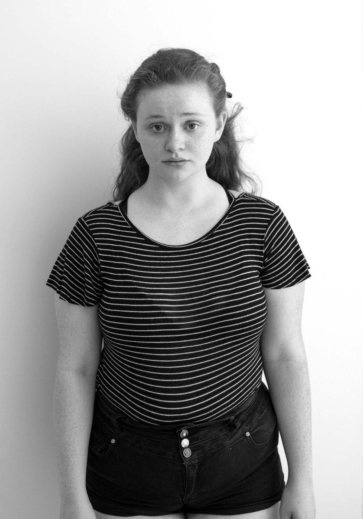 Before shot of a young woman in a striped top.