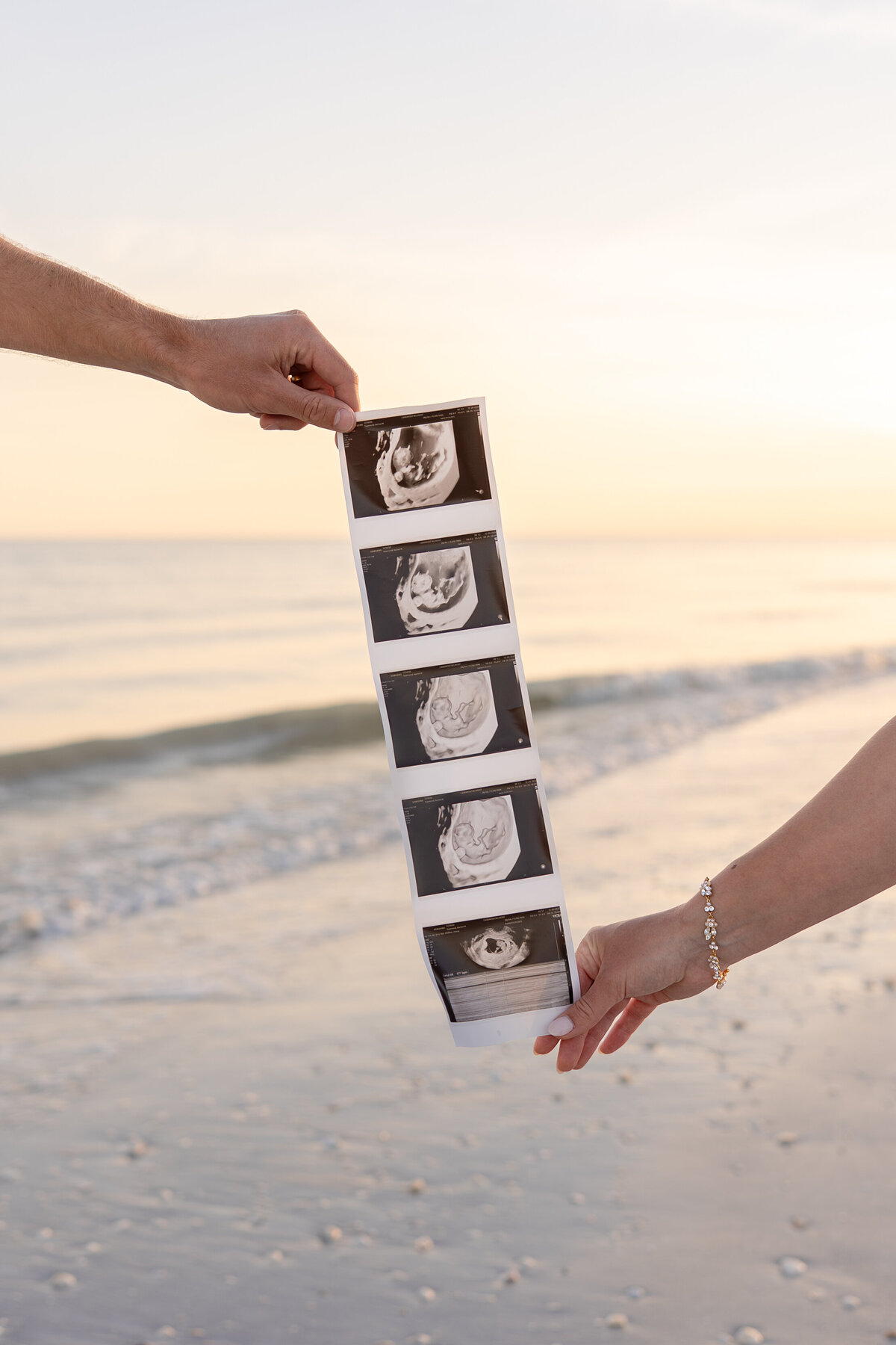 Gomes Films - Maternity-10