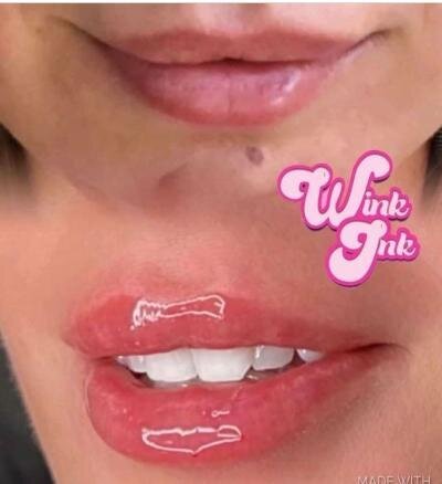lip10