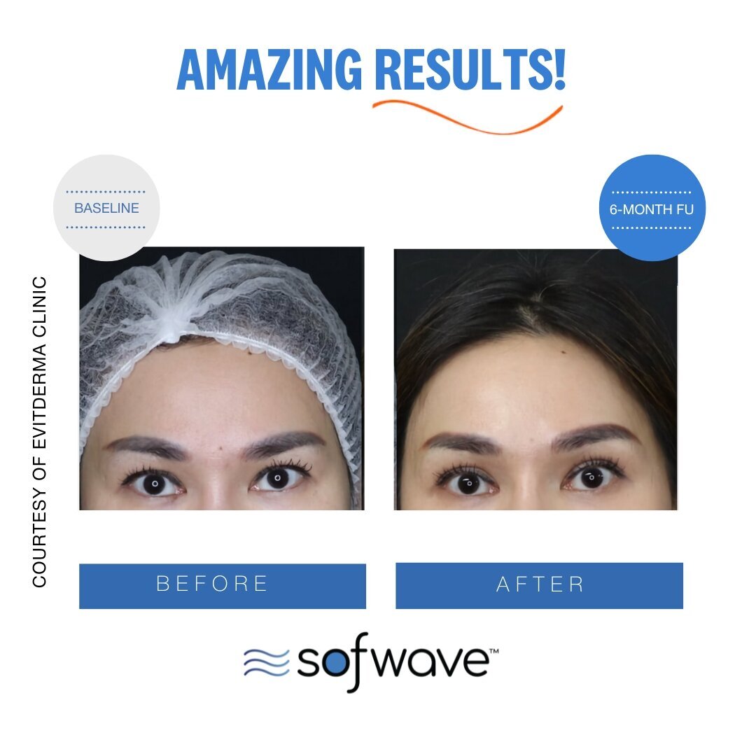 Set-50-Eyebrow-Skin-Type-4