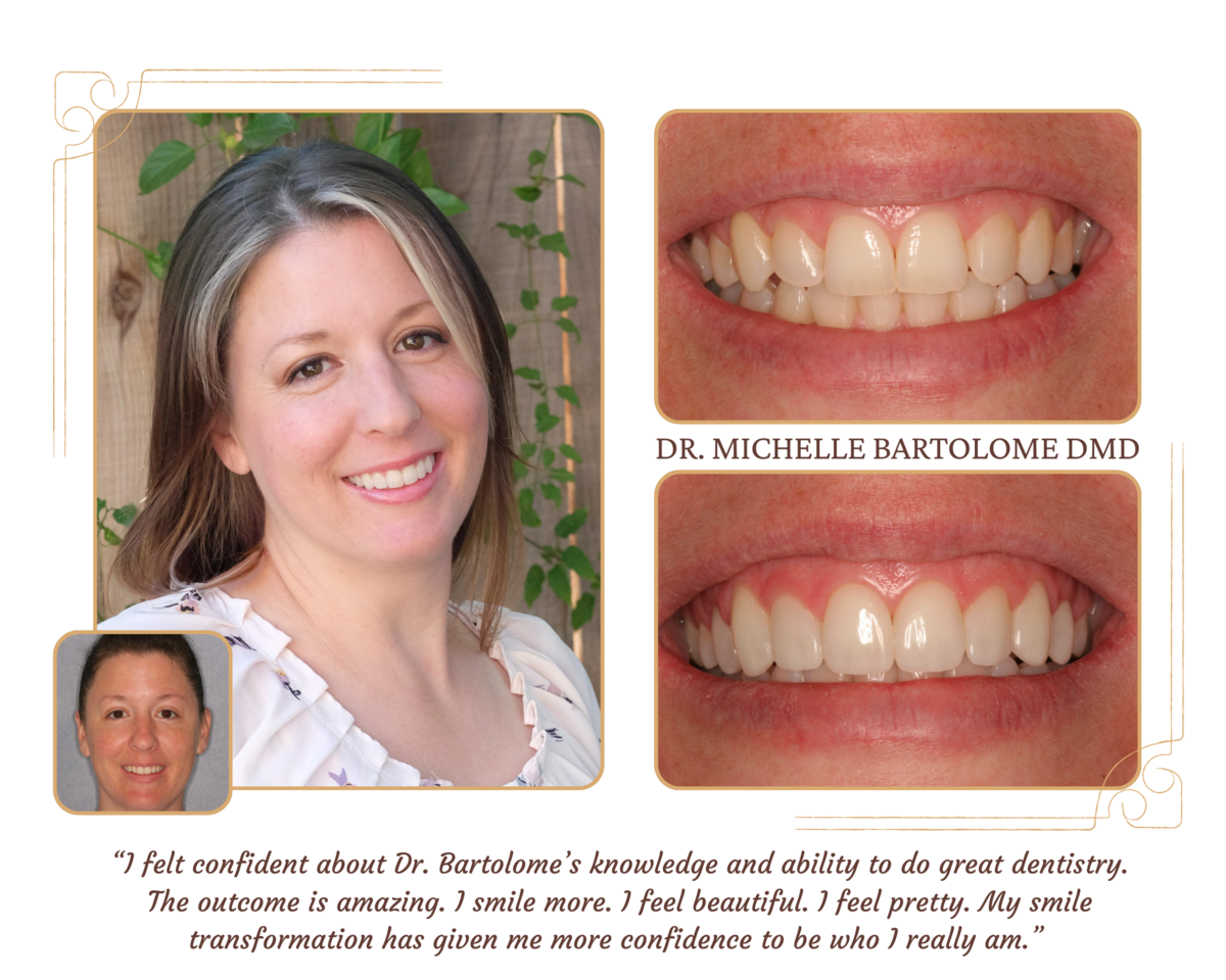 Smile Makeover (2)
