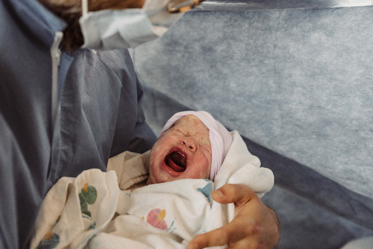 cesarean-birth-photography-natalie-broders-c-026