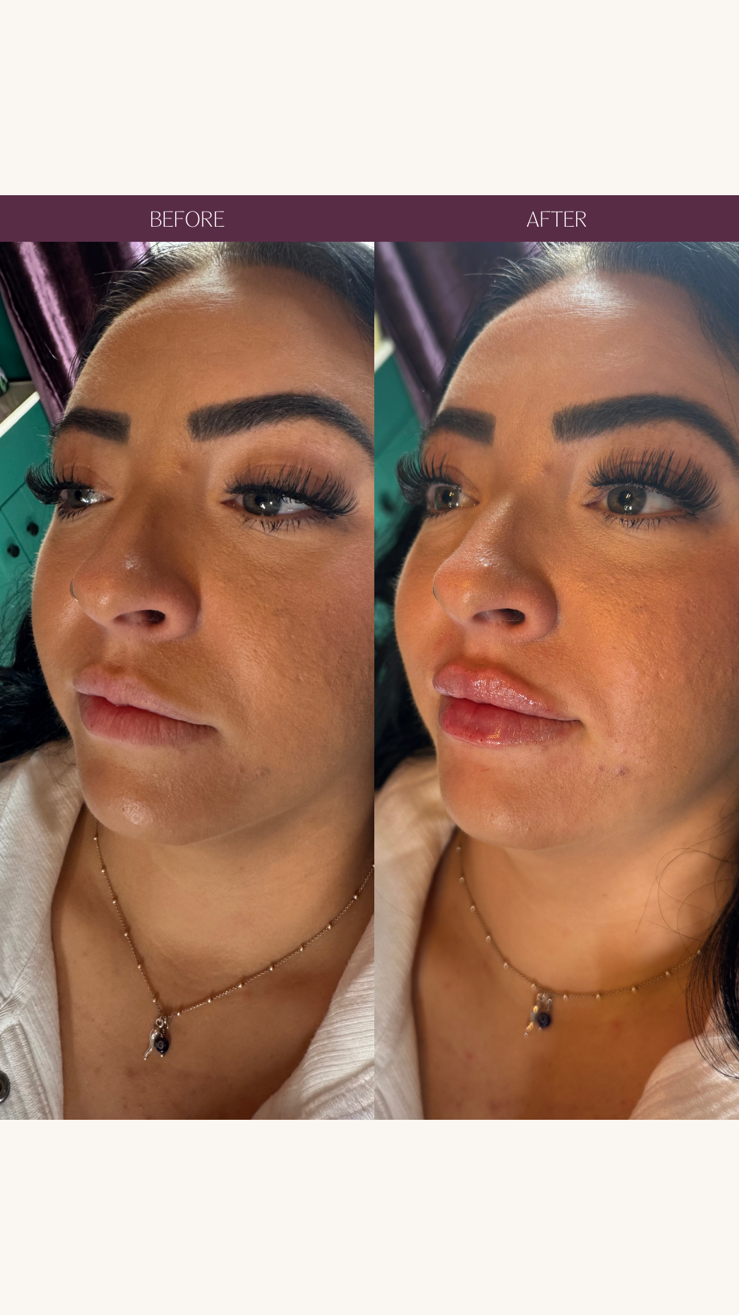 Copy of Before and Afters (Portrait Size).png 4