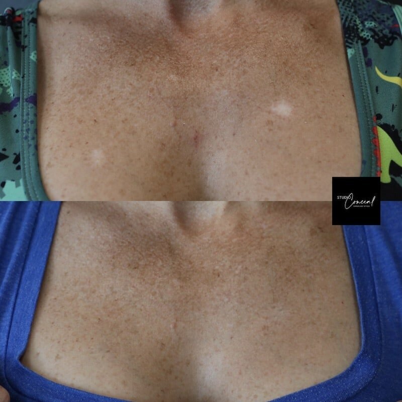 jennifer-chest-2