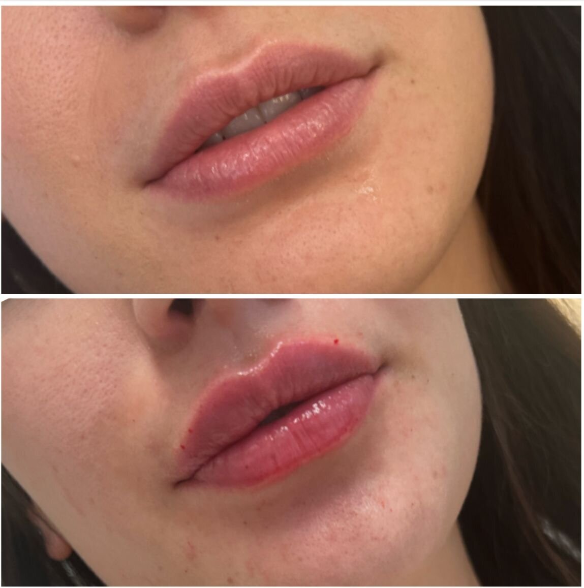 compressed-Lip-Wrinkles- Lip-volume-nd-some-brand-pics-14