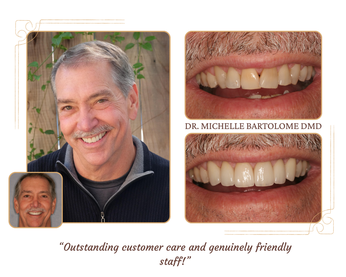 Smile Makeover (10)