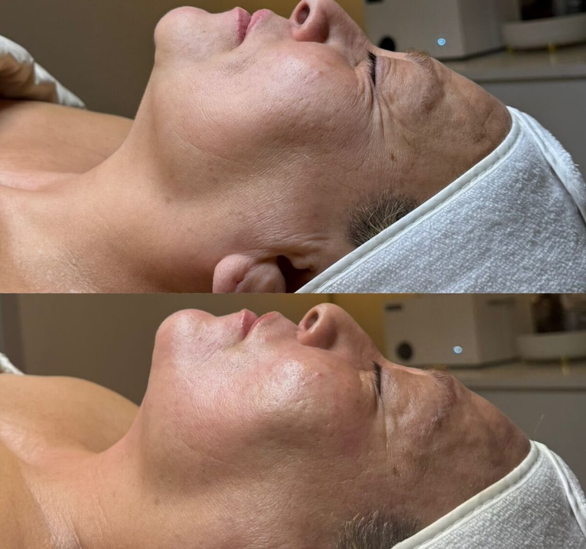 boujee-beaute-bar-skin-transformations-09