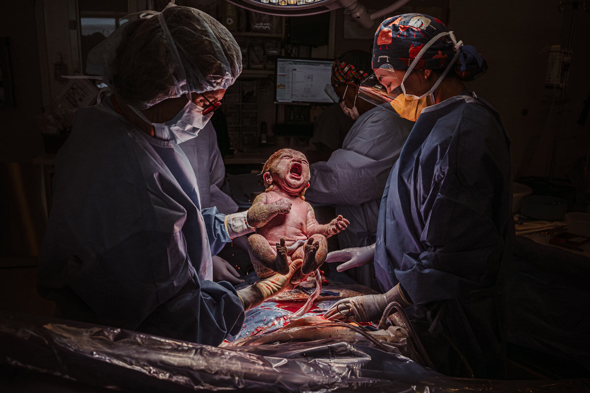 cesarean-birth-photography-natalie-broders-c-018