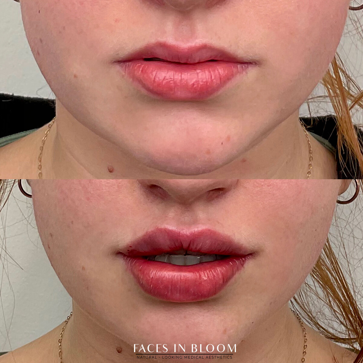 BEFORE-AFTER01-copy copy 8