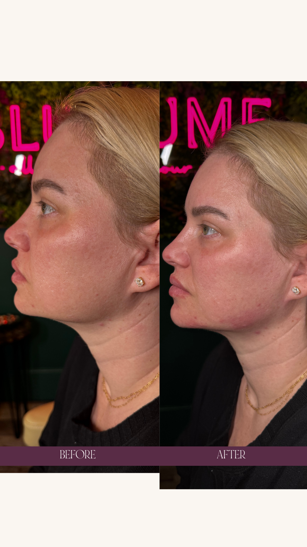 Copy of Before and Afters (Portrait Size).png 6