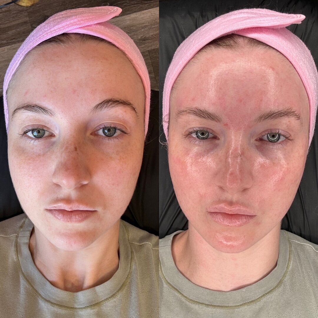brown elegant beauty skincare instagram post (6)