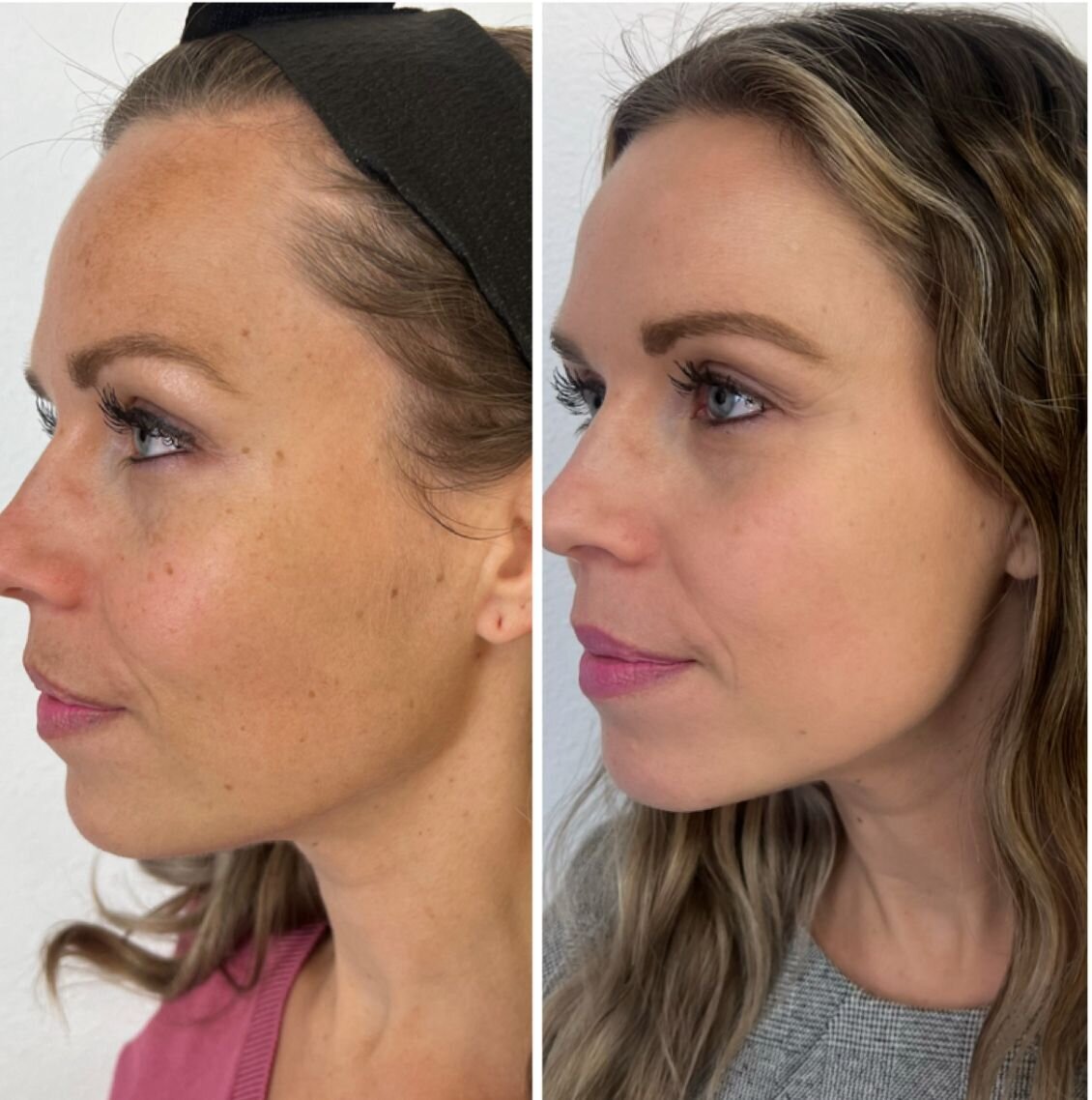 compressed-missing-laser-images-before-after-08