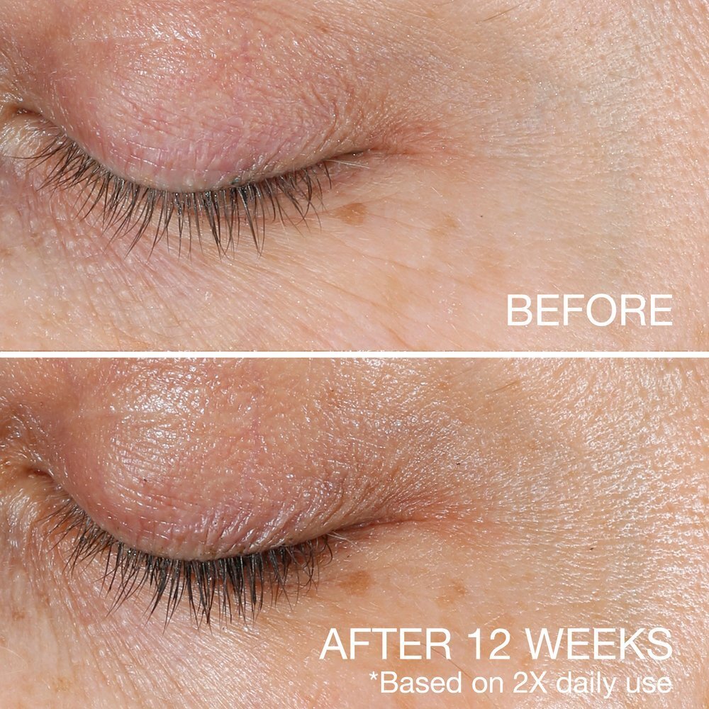 Neutrogena_00006989_ECOM_SEC_004