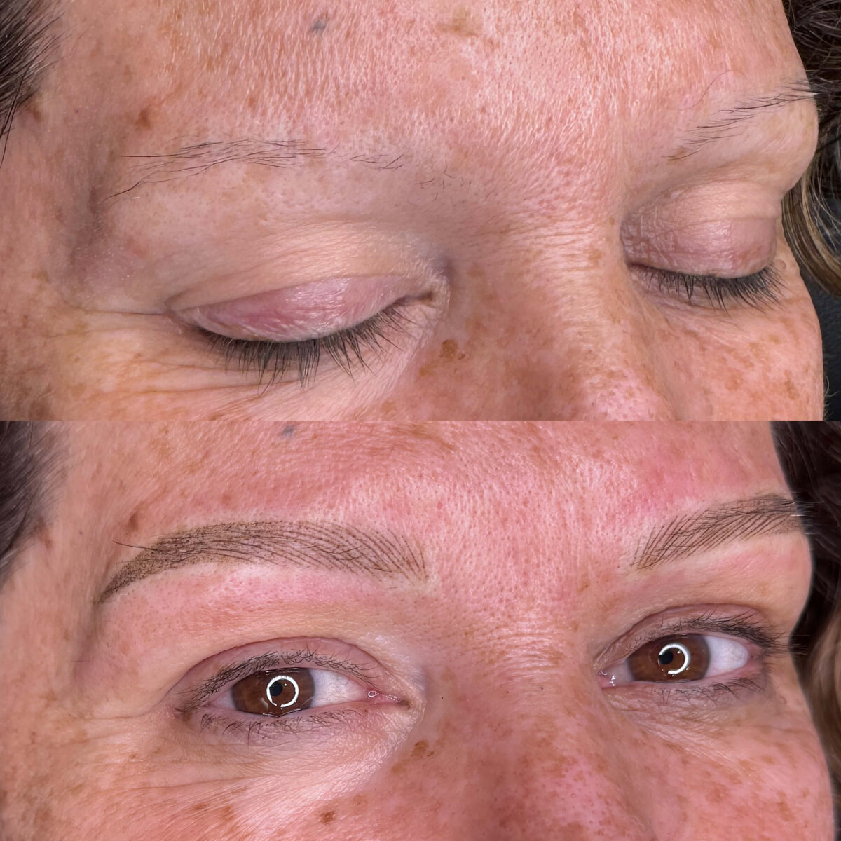 New nano on mature skin