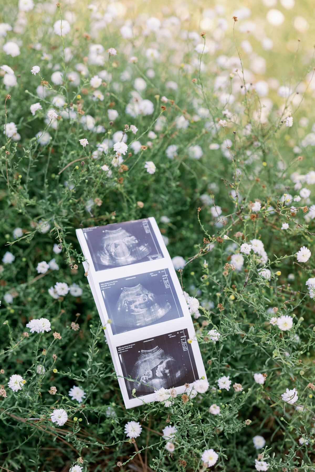 Adkins_Maternity_Family-270