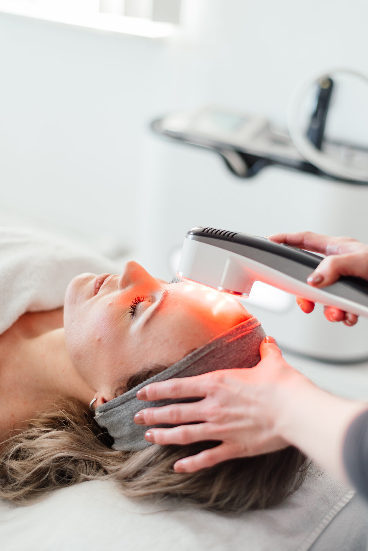 Acne behandelingen laser - - Salon Perfect Skin - 82