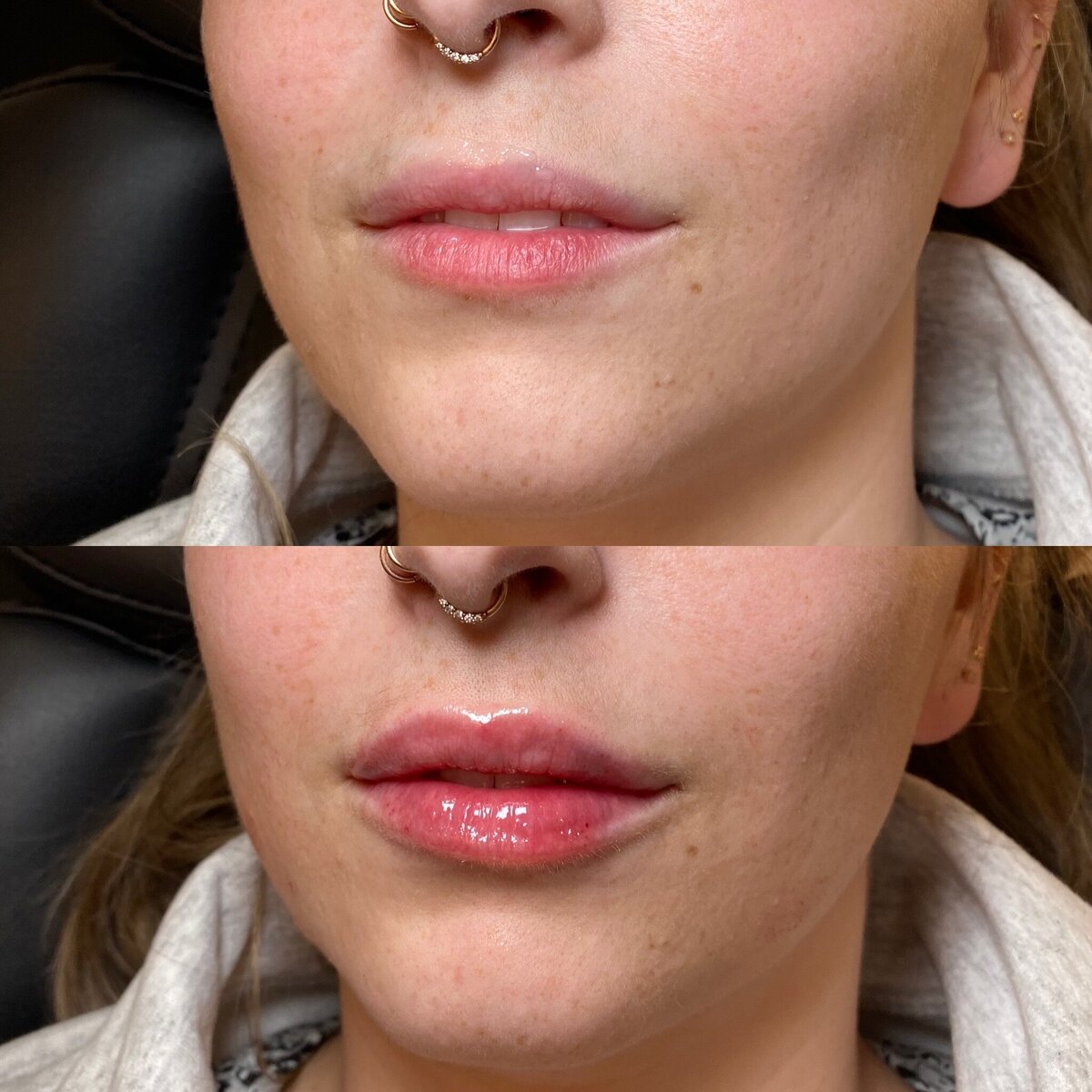 BalancedBeautyBotoxWestwood17