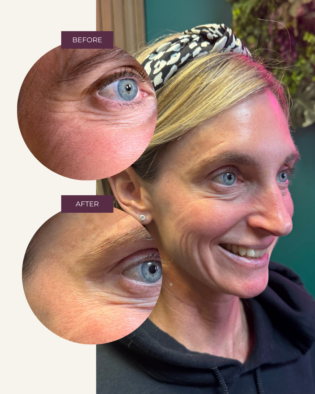 Copy of Before and Afters (Portrait Size).png