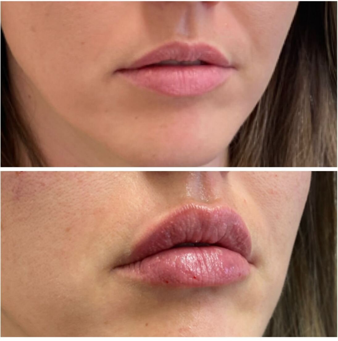 compressed-Lip-Wrinkles- Lip-volume-nd-some-brand-pics-01