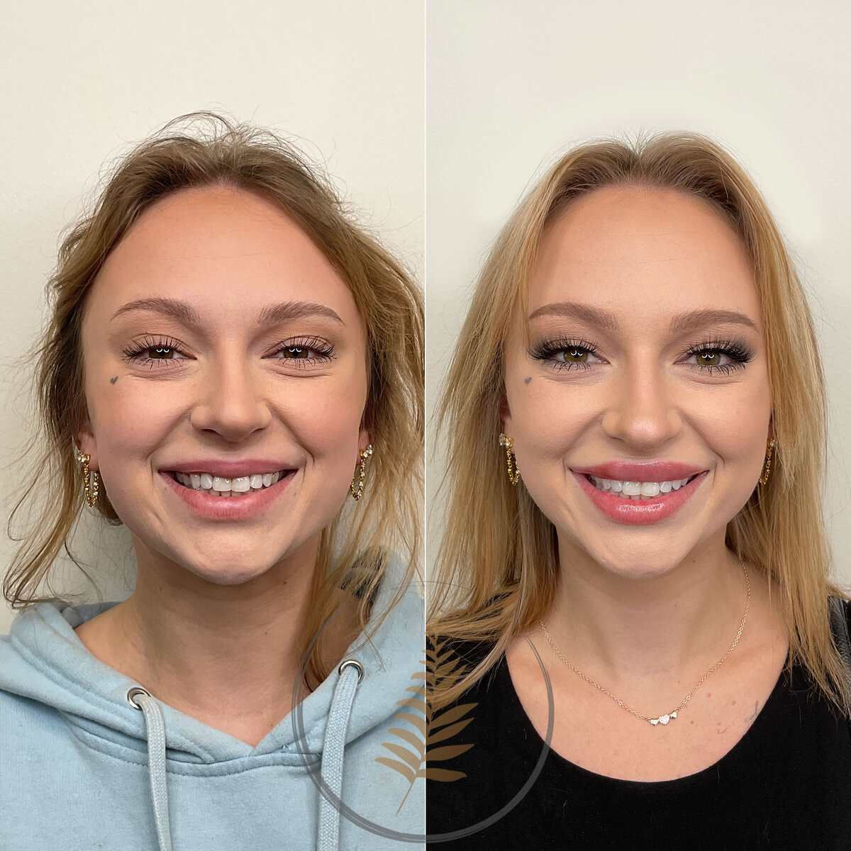 FACESINBLOOM_BEFOREAFTER_LIPS_01