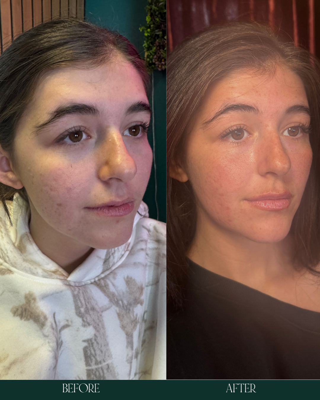 Copy of Before and Afters (Portrait Size).zip - 3