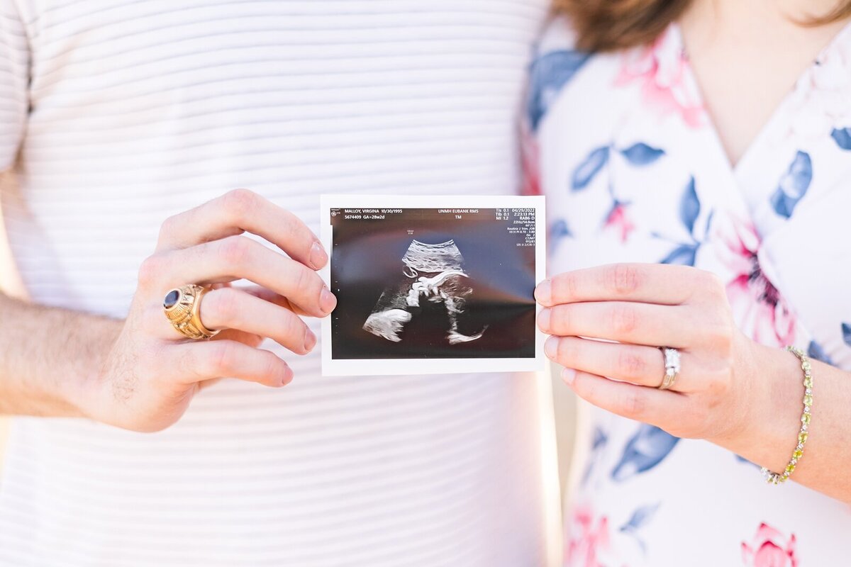 New parents holding their ultrasound photo