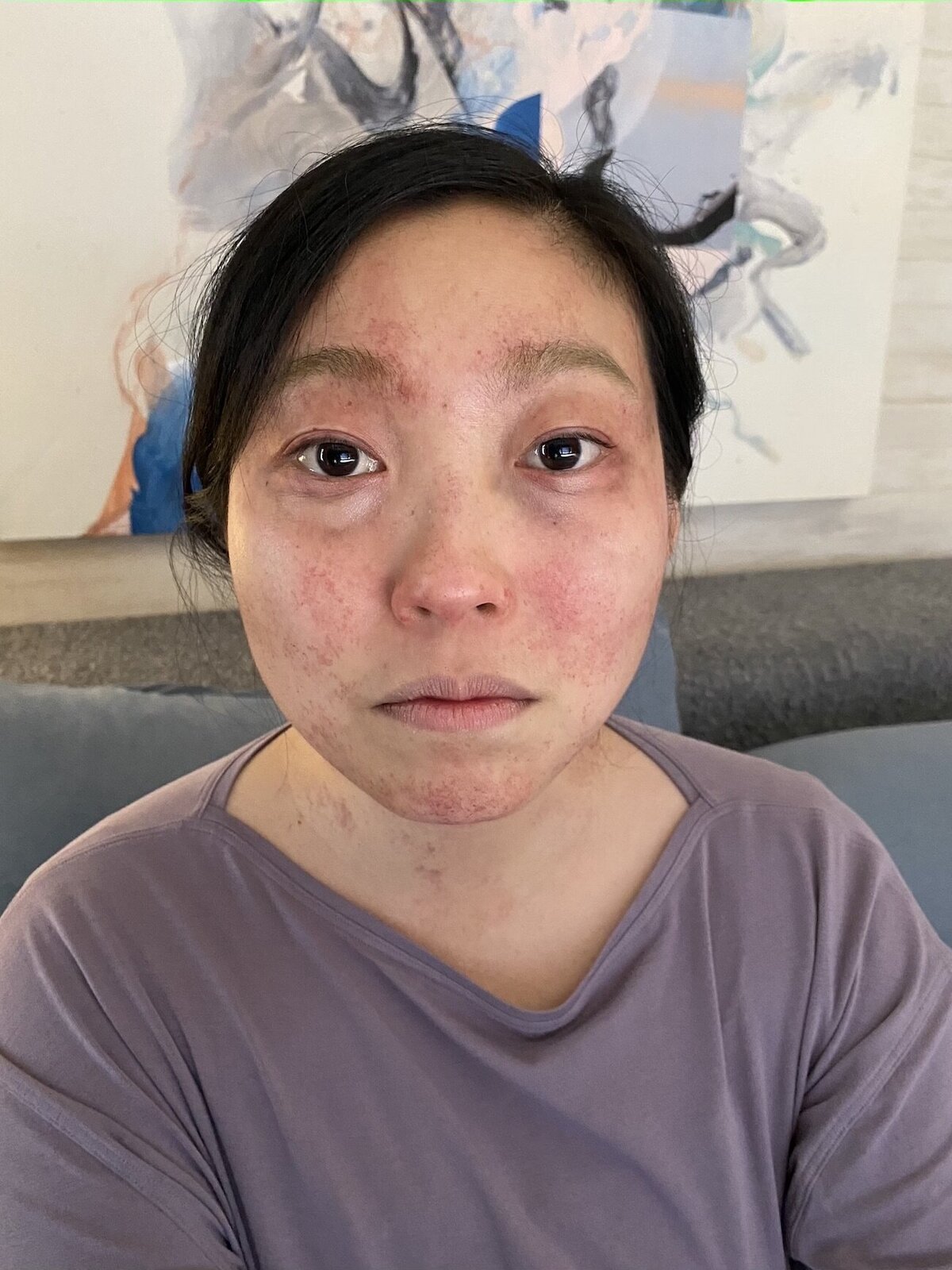 woman-fake-bruises-face-makeup-fx