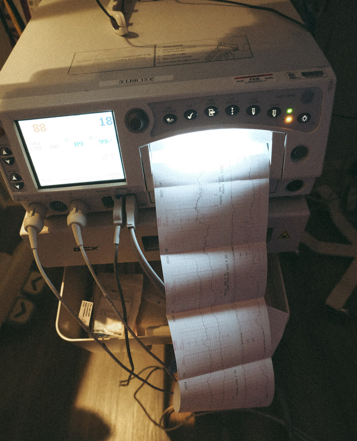Hospital-Vitals