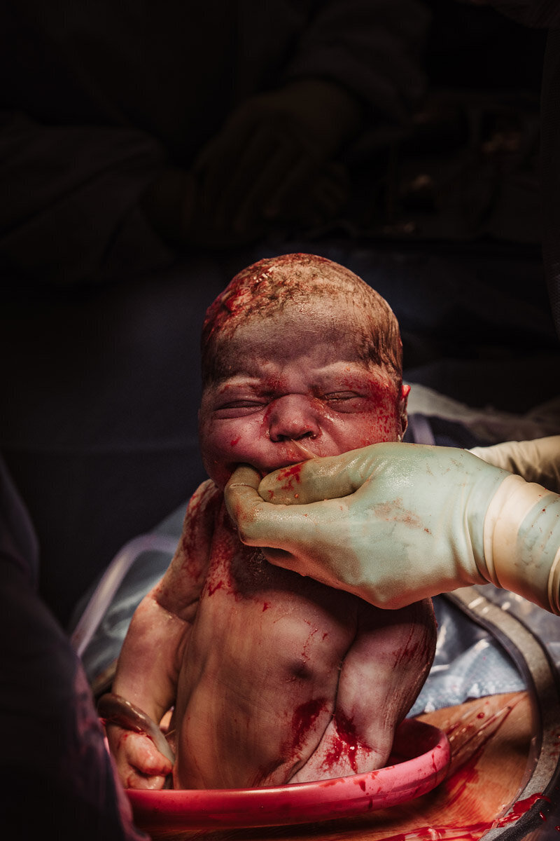 cesarean-birth-photography-natalie-broders-d-076