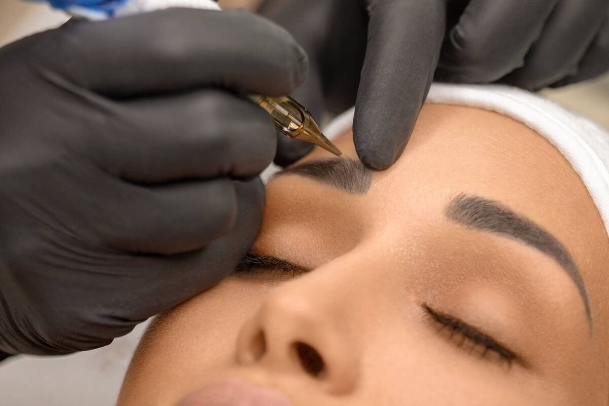Permanent makeup acid removal New York