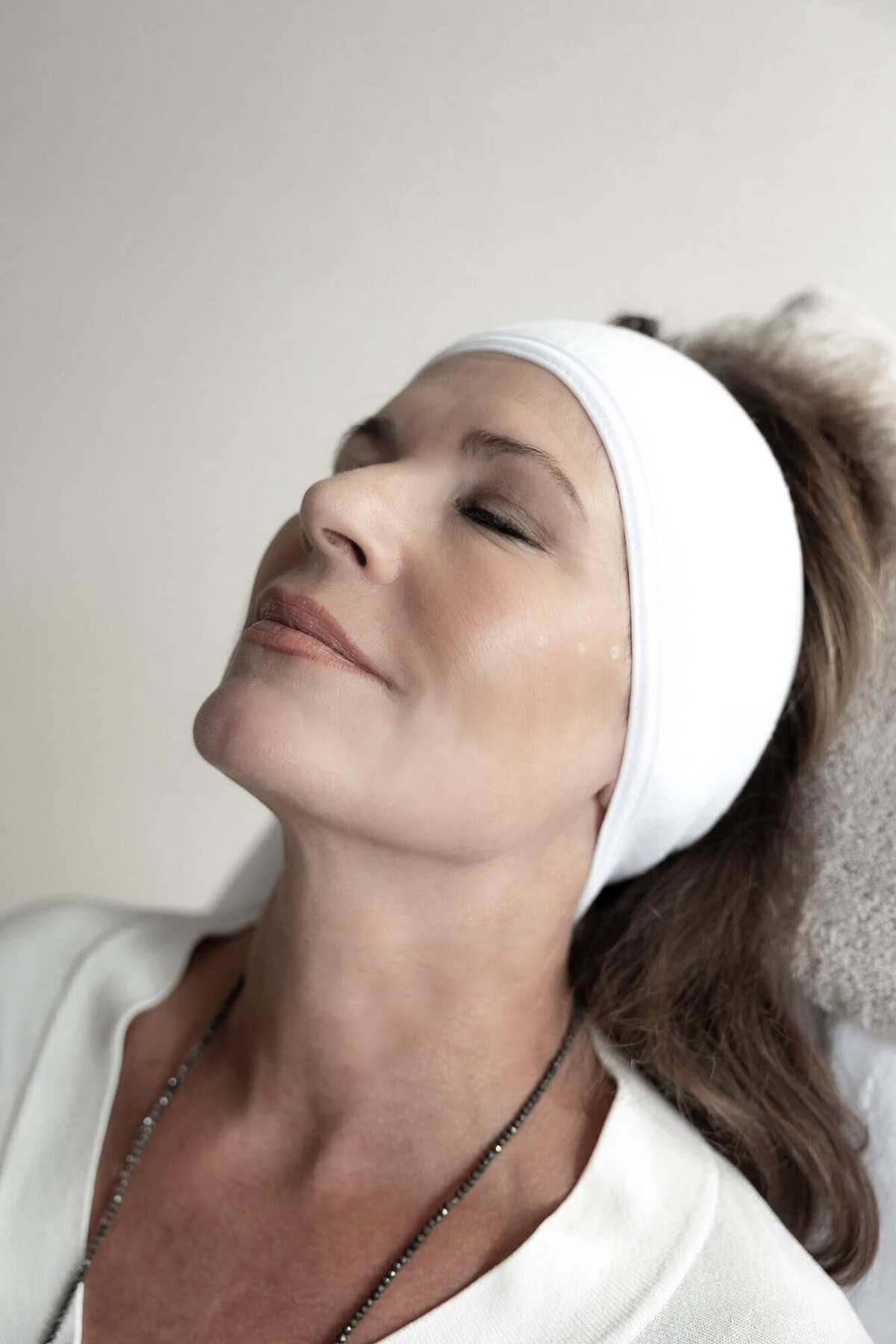 Skinbooster Profhilo door drs Lizenka Adriaanse cosmetisch arts Rotterdam