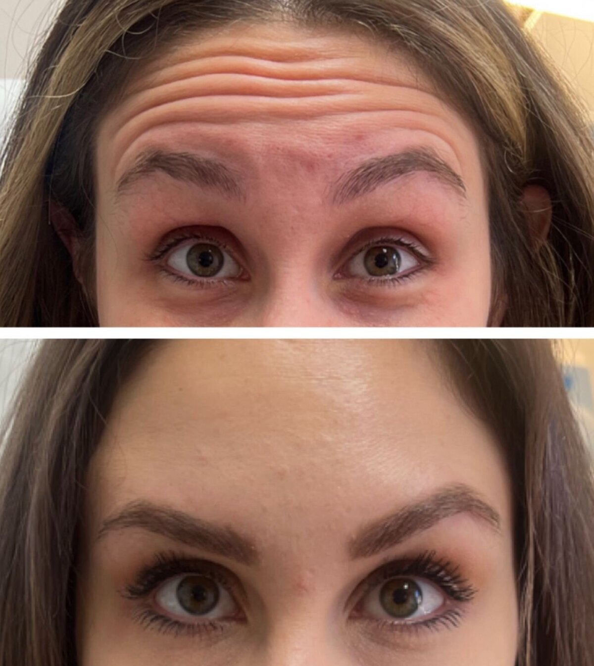 compressed-Neuromodulator-before-after-19