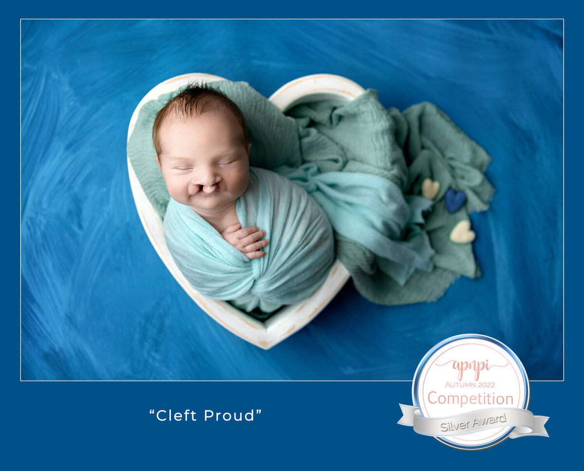 award winning portrait of a newborn with a cleft lip in a heart shaped bowl on a blue background
