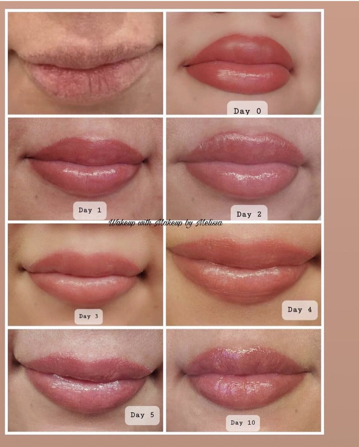 lips2