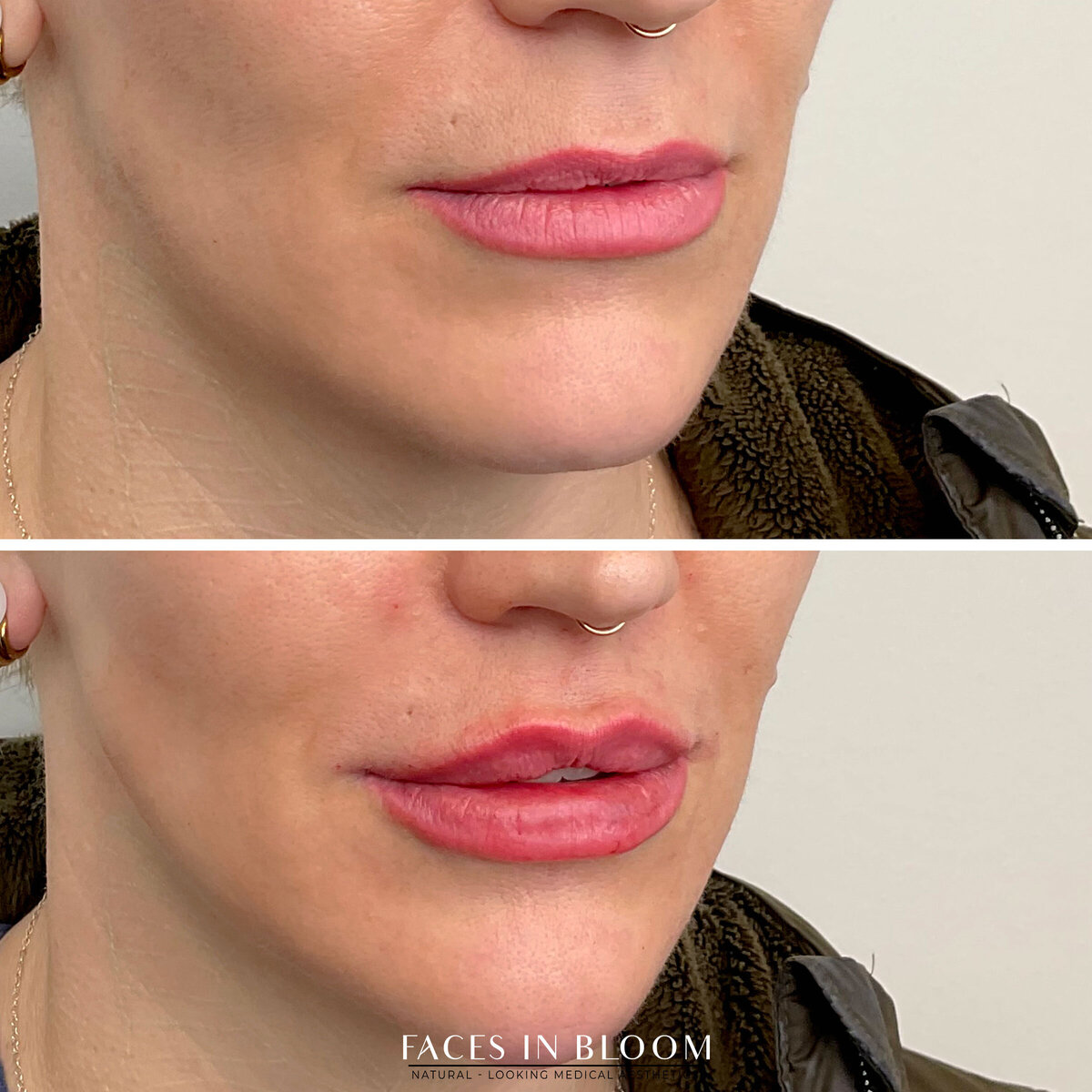 BEFORE-AFTER01-copy copy 4