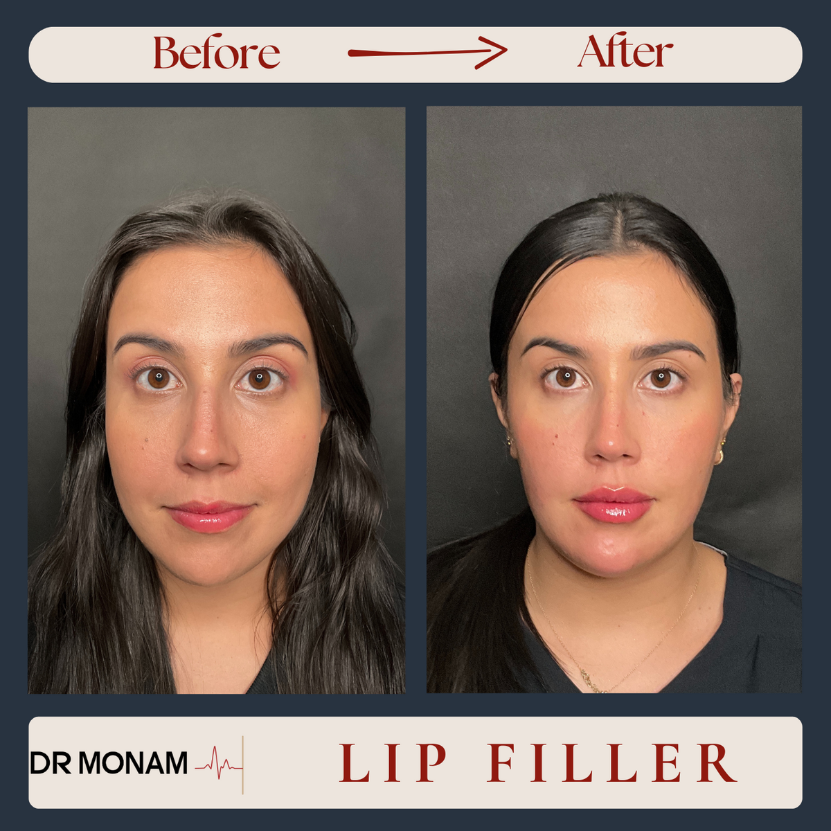 Neutral Before and After Instagram Post-13