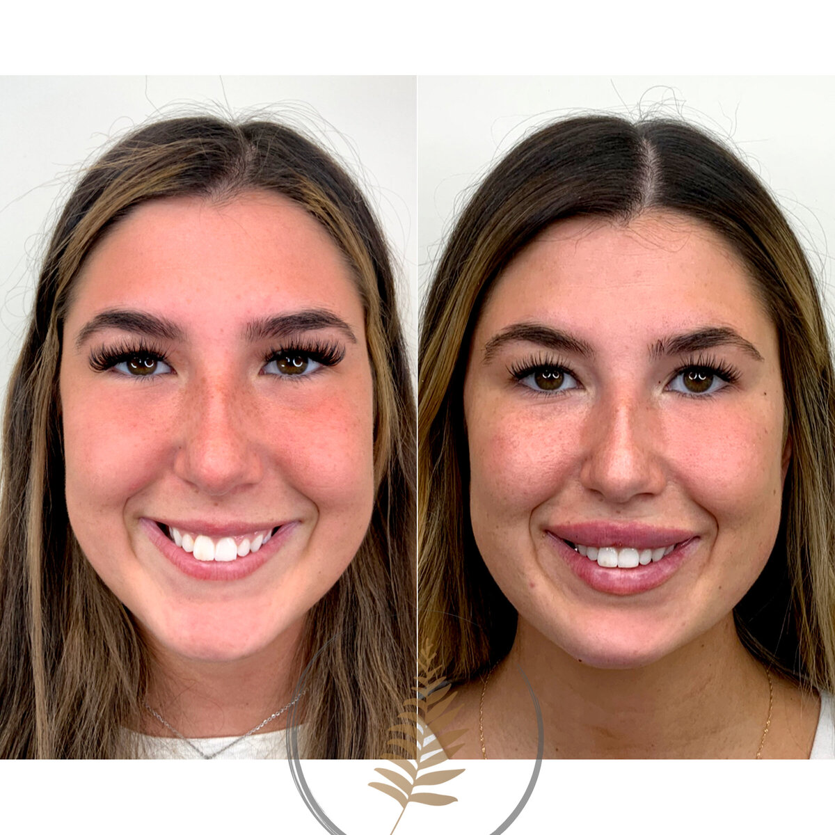 BEFORE:AFTER02 copy 23